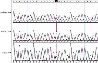 Case report: Congenital hyperinsulinemia with ABCC8 gene mutations